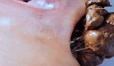 Turds Direct In Your Throat