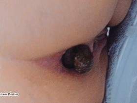 Strain Constipated Turds