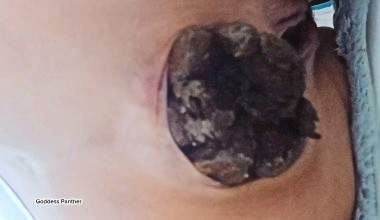 Strain Constipated Turds
