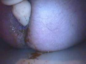 Pump Plug