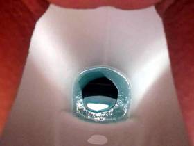 Poop 87.2015