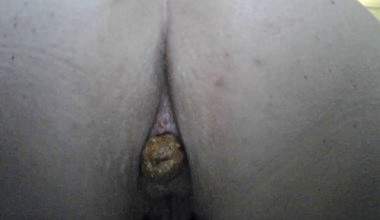 Der pralle Arsch kackt im close up