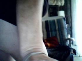 * 9 * The pressure was contrast quite young again.