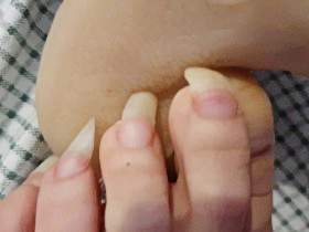 Scratch Your Balls