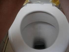 After two days, finally shitting