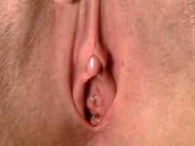 Pissen auf die Linse