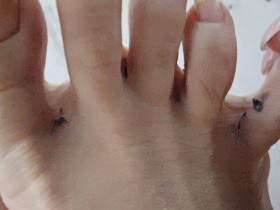 Clean Between Toes