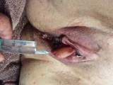 very close the doc injects