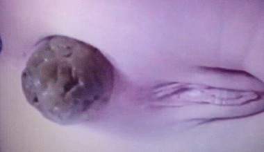 SUSI SCHISS und PISS