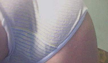 Nase  Matchen *NS*NS*NS*