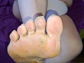 leck - küss & rich meine ungepflegten reifen Füße