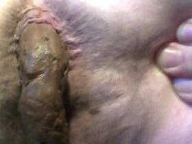 Vorschaubild vom Privatporno mit dem Titel "*110* Vom 28.02.10. Meine Irre Geile Möse & dann beim Mega Scheißen !" von Kuschelbaer222