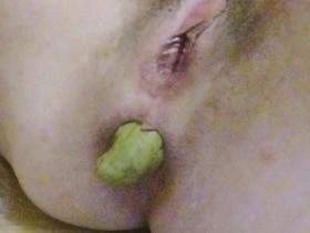 Kacken,  ohne Ende...breitbeinig, auf dich zu