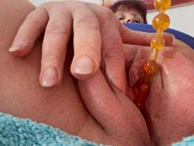 Yellow anal chain