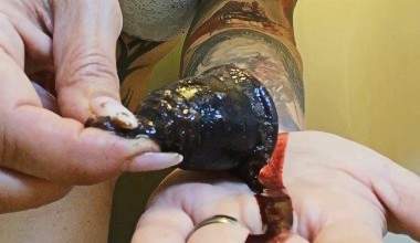 Blutiges Perioden Klumpen geschmieren