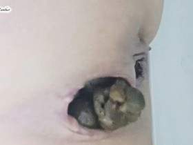 Constipated Huge Dose