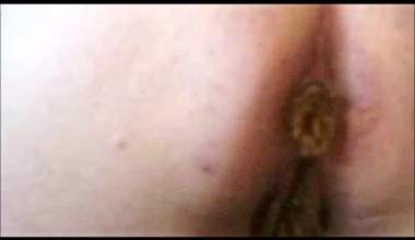 WIEDER MAL SCHISS & PISS