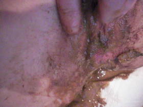 4 finger und eine kv fotze