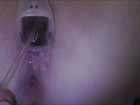 Vorschaubild vom Privatporno mit dem Titel "Fotze aufgerissen2...gepisst bis zum Gebärmutterhals" von sexyvenushuegel