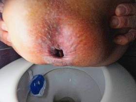 Toilet shit closeup