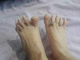 Ring Toes