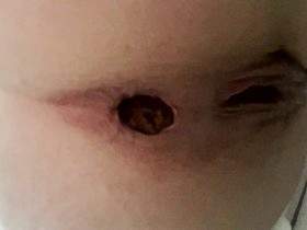 Huge Shit In Toilet