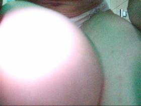 Full Hößchenschiss