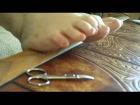 Cut toenails and calluses