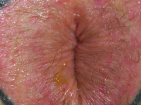 My hole -01